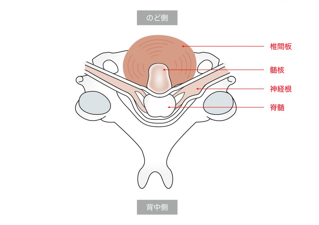 腰椎・頚椎を上から見た断面図